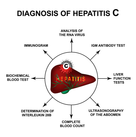 Diagnosis Of Hepatitis C infographic